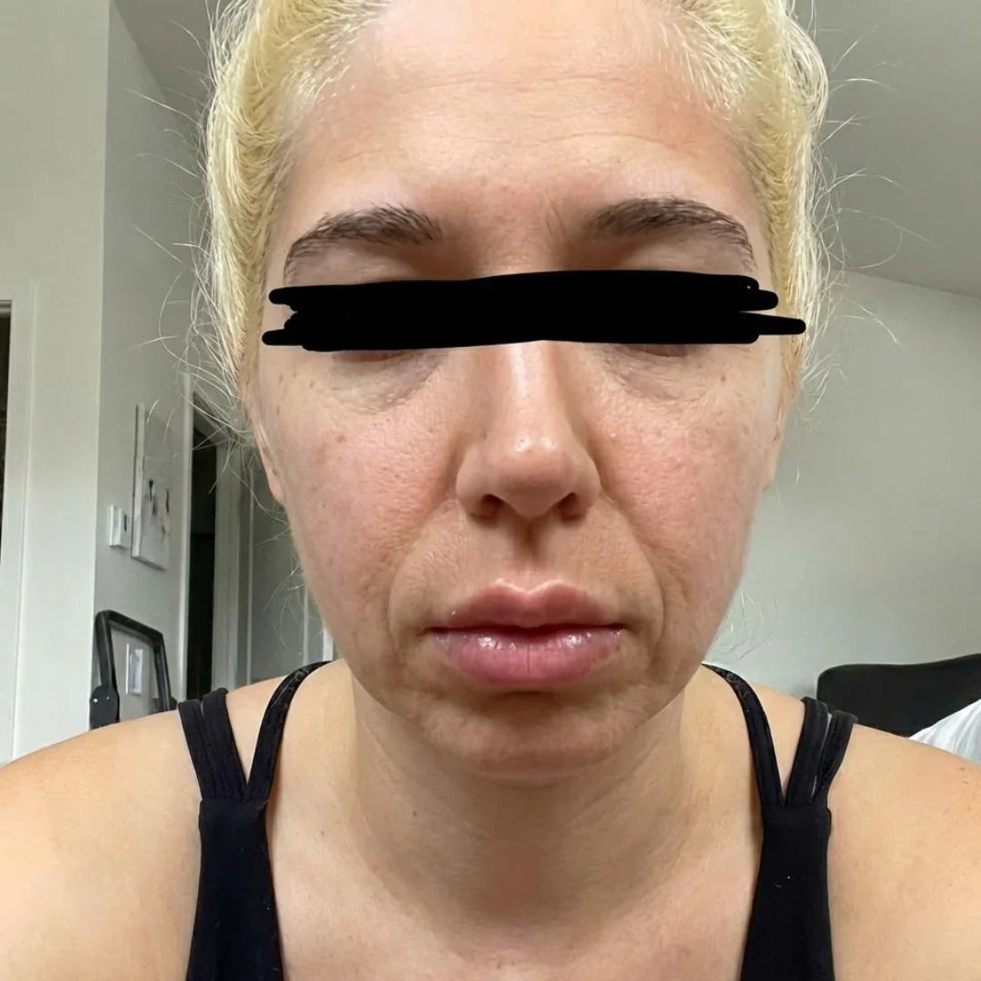 Cara hinchada al despertar, piernas pesadas al acabar el día: 5 señales de que tu sistema linfático está congestionado — y por qué beber más agua no lo soluciona